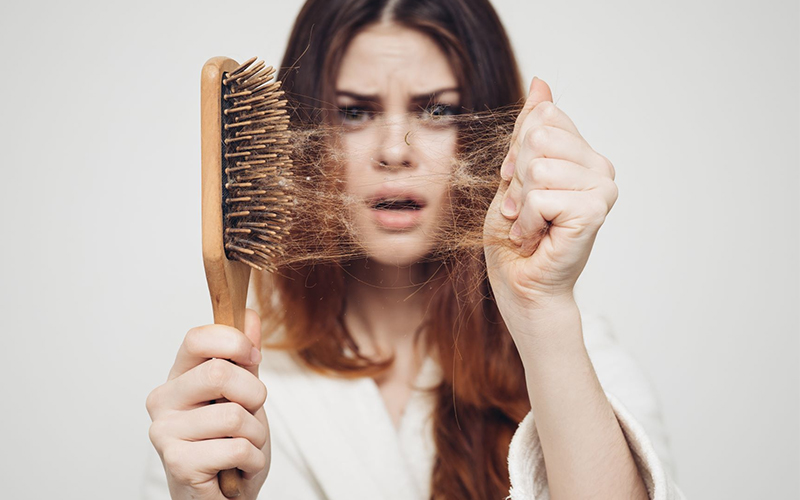 عوامل ژنتیکی ریزش مو در بانوان